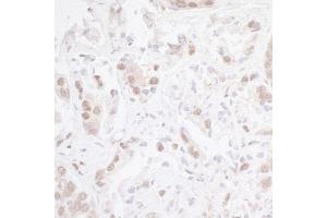Immunohistochemistry (IHC) image for anti-Chromodomain Helicase DNA Binding Protein 8 (CHD8) (AA 2252-2302) antibody (ABIN7448888)