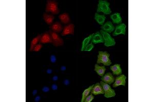 Phospho-Nucleophosmin (Ser125) Antibody staining Hela cells(heat shock treatment) by IF/ICC.