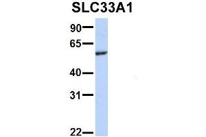 Host:  Rabbit  Target Name:  WT1  Sample Type:  721_B  Antibody Dilution:  1. (SLC33A1 Antikörper  (Middle Region))