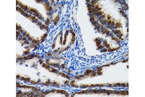 Immunohistochemistry of paraffin-embedded Rat fallopian tube using HSPH1 Polyclonal Antibody at dilution of 1:100 (40x lens). (HSPH1 Antikörper)