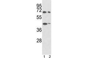 Western Blotting (WB) image for anti-Protein tyrosine Phosphatase, Non-Receptor Type 11 (PTPN11) (AA 526-551) antibody (ABIN3032394)