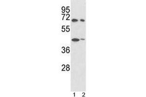 Western blot analysis of SHP2 antibody and 1) 293, 2) K562 lysate. (PTPN11 Antikörper  (AA 526-551))
