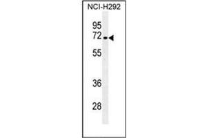 Western blot analysis of NUMB Antibody (N-term) in NCI-H292 cell line lysates (35ug/lane).