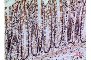 Immunohistochemistry (IHC) image for anti-Protein tyrosine Phosphatase, Receptor Type, J (PTPRJ) (Internal Region) antibody (ABIN6285228)