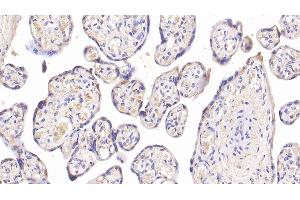 Detection of INSR in Human Placenta Tissue using Monoclonal Antibody to Insulin Receptor (INSR) (Insulin Receptor Antikörper)