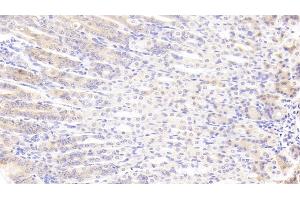Immunohistochemistry (IHC) image for anti-Thrombospondin 2 (THBS2) (AA 968-1170) antibody (ABIN7435625)
