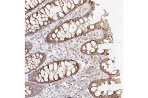 Immunohistochemical staining of human colon with TBC1D14 polyclonal antibody  shows moderate cytoplasmic positivity in glandular cells.