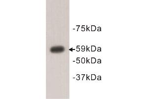 Western Blotting (WB) image for anti-Autoimmune Regulator (AIRE) antibody (ABIN1854830) (AIRE Antikörper)