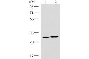 Western blot analysis of 293T cell lysates using CBR3 Polyclonal Antibody at dilution of 1:800 (CBR3 Antikörper)