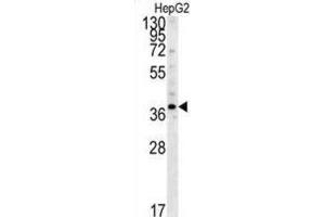 Western Blotting (WB) image for anti-Proteasome (Prosome, Macropain) 26S Subunit, Non-ATPase, 7 (PSMD7) antibody (ABIN3001711) (PSMD7 Antikörper)