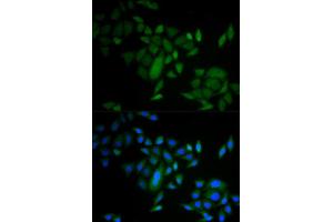 Immunofluorescence analysis of A549 cell using CASP9 antibody. (Caspase 9 Antikörper)