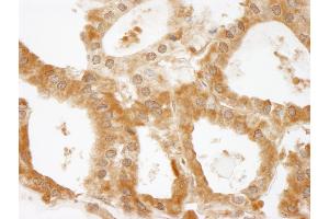 Immunohistochemistry (IHC) image for anti-Coiled-Coil and C2 Domain Containing 1A (CC2D1A) (AA 1-50) antibody (ABIN7448937) (CC2D1A Antikörper  (AA 1-50))