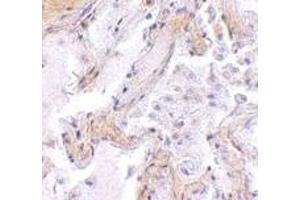 Immunohistochemistry of CAPN6 in human lung tissue with CAPN6 antibody at 2. (Calpain 6 Antikörper  (C-Term))