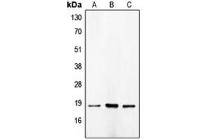 Western blot analysis of p18 INK4c expression in HeLa (A), NIH3T3 (B), COLO205 (C) whole cell lysates. (CDKN2C Antikörper  (C-Term))