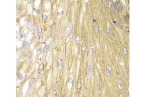 Immunohistochemistry (Paraffin-embedded Sections) (IHC (p)) image for anti-Protein Phosphatase 2 Regulatory Subunit 2A (PPP2R2A) antibody (ABIN7260281)