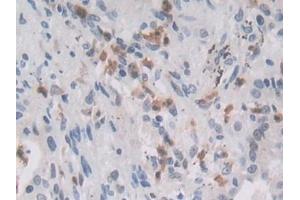 Immunohistochemistry (IHC) image for anti-E3 ubiquitin-protein ligase MIB2 (MIB2) (AA 687-930) antibody (ABIN7439483)
