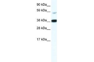 WB Suggested Anti-RELB Antibody Titration:  2. (RELB Antikörper  (Middle Region))