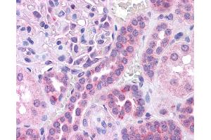 Immunohistochemistry (IHC) image for anti-V-Maf Musculoaponeurotic Fibrosarcoma Oncogene Homolog (Avian) (MAF) (N-Term) antibody (ABIN2780675) (MAF Antikörper  (N-Term))