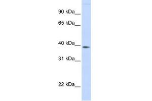 WB Suggested Anti-FAM76B Antibody Titration: 0. (FAM76B Antikörper  (Middle Region))