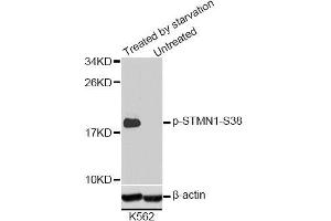 Western blot analysis of extracts of K-562 cells, using Phospho-STMN1-S38 antibody (ABIN2987644). (Stathmin 1 Antikörper  (pSer38))