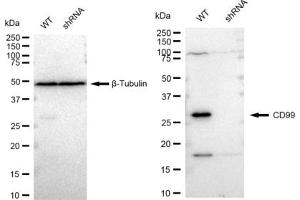 anti-CD99 (CD99) antibody