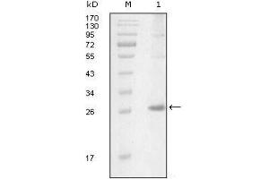 Western Blot showing ITK antibody used against truncated Trx-ITK recombinant protein (1). (ITK Antikörper  (AA 2-110))