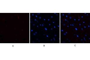 Immunofluorescence analysis of rat heart tissue. (E2F1 Antikörper  (AA 100-170))