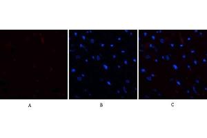 Immunofluorescence analysis of rat heart tissue. (E2F1 Antikörper  (AA 100-170))