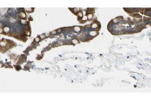 ABIN6268853 at 1/100 staining Mouse intestine tissue by IHC-P. (CRHR2 Antikörper  (Internal Region))