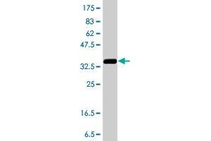 Western Blot detection against Immunogen (37. (BCOR Antikörper  (AA 1361-1460))