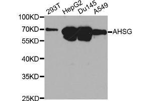 Western blot analysis of extracts of various cell lines, using AHSG antibody. (Fetuin A Antikörper)