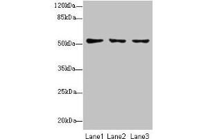 Western blot All lanes: SLC46A2 antibody at 8 μg/mL Lane 1: HT29 whole cell lysate Lane 2: Mouse liver tissue Lane 3: Mouse kidney tissue Secondary Goat polyclonal to rabbit IgG at 1/10000 dilution Predicted band size: 52 kDa Observed band size: 52 kDa (SLC46A2 Antikörper  (AA 45-78))