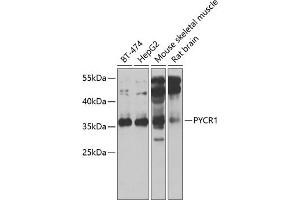 Western blot analysis of extracts of various cell lines, using PYCR1 antibody (ABIN6133044, ABIN6146518, ABIN6146520 and ABIN6222710) at 1:1000 dilution. (PYCR1 Antikörper  (AA 1-319))