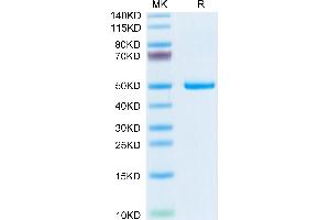 SDS-PAGE (SDS) image for Phospholipase A2, Group IB (PLA2G1B) (AA 23-146) protein (Fc Tag) (ABIN7275463)