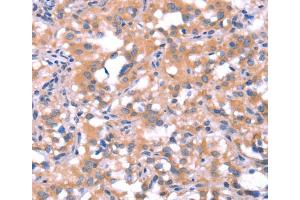 Immunohistochemistry (IHC) image for anti-FAT Tumor Suppressor Homolog 1 (FAT1) antibody (ABIN2434638) (FAT1 Antikörper)