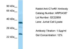 Western Blotting (WB) image for anti-Chromosome 7 Open Reading Frame 61 (C7orf61) (C-Term) antibody (ABIN2785686) (C7orf61 Antikörper  (C-Term))