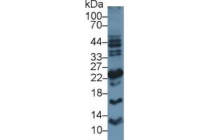 Detection of APOM in Human Placenta lysate using Polyclonal Antibody to Apolipoprotein M (APOM) (Apolipoprotein M Antikörper  (AA 8-188))