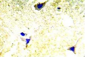 Immunohistochemistry (IHC) analyzes of PAK1/2 antibody in paraffin-embedded human brain tissue. (PAK1 Antikörper)