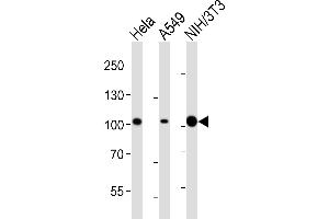 Western blot analysis of lysates from Hela, A549, mouse NIH/3T3 cell line (from left to right), using FER Antibody (ABIN6243360 and ABIN6577092). (FER Antikörper  (AA 1-300))