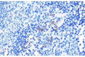Immunohistochemistry (Paraffin-embedded Sections) (IHC (p)) image for anti-Integrin alpha-L (ITGAL) antibody (ABIN7259162)
