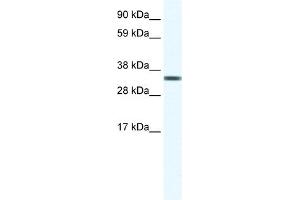 WB Suggested Anti-TCEA1 Antibody Titration:  1. (TCEA1 Antikörper  (Middle Region))