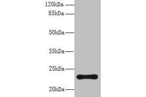 Western blot All lanes: AP3S2 antibody at 6 μg/mL + A549 whole cell lysate Secondary Goat polyclonal to rabbit IgG at 1/10000 dilution Predicted band size: 23, 44, 15 kDa Observed band size: 23 kDa (AP3S2 Antikörper  (AA 1-193))