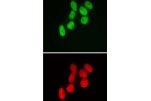 Immunofluorescence (IF) image for anti-SWI/SNF Related, Matrix Associated, Actin Dependent Regulator of Chromatin, Subfamily B, Member 1 (SMARCB1) antibody (ABIN6972743)