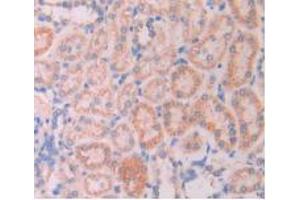 IHC-P analysis of Rat Kidney Tissue, with DAB staining. (LAMP2 Antikörper  (AA 191-362))