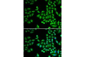 Immunofluorescence analysis of MCF-7 cells using PTPN1 antibody (ABIN5970769). (PTPN1 Antikörper)