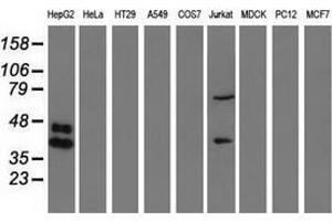 Western blot analysis of extracts (35 µg) from 9 different cell lines by using anti-HP monoclonal antibody. (Haptoglobin Antikörper)
