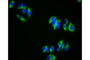 Immunofluorescence staining of HepG2 cells with ABIN7145704 at 1:333, counter-stained with DAPI. (BMPR1A Antikörper  (AA 177-532))