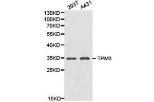 Western Blotting (WB) image for anti-Tropomyosin 3 (TPM3) antibody (ABIN1875182) (TPM3 Antikörper)