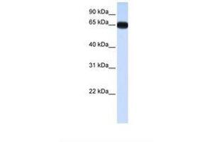 Image no. 1 for anti-Distal-Less Homeobox 4 (DLX4) (AA 38-87) antibody (ABIN6737752) (DLX4 Antikörper  (AA 38-87))