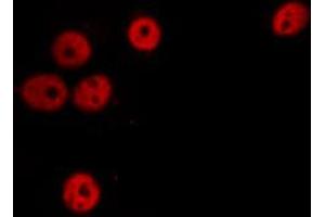 ABIN6274305 staining Hela cells by IF/ICC.